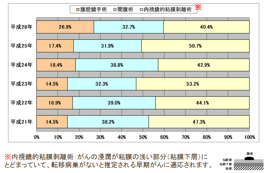 胃癌手術における腹腔鏡手術の割合のグラフ