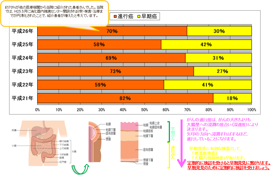 大腸癌手術施行患者における、進行がんと早期がんの割合のグラフ